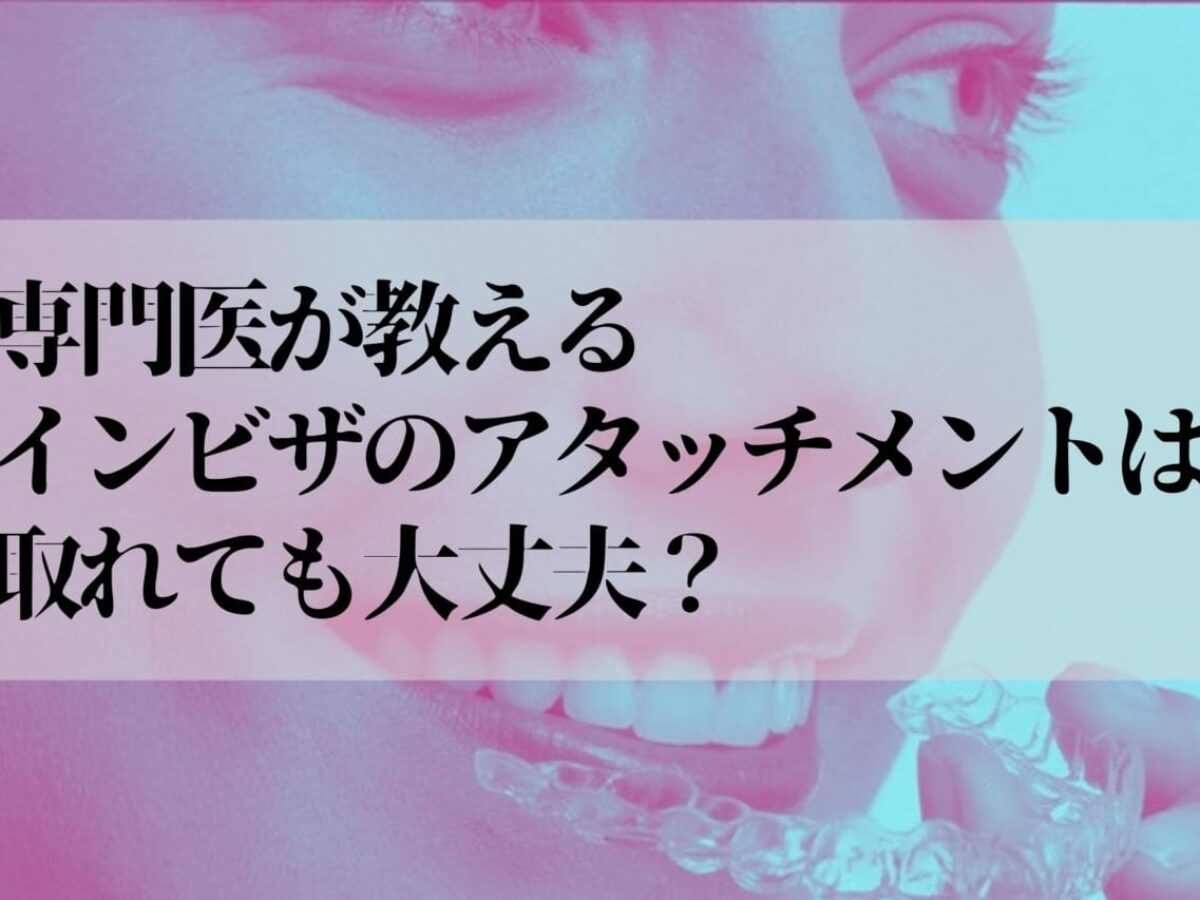 インビザラインのアタッチメントとは？食事・歯磨きで取れる？徹底解説