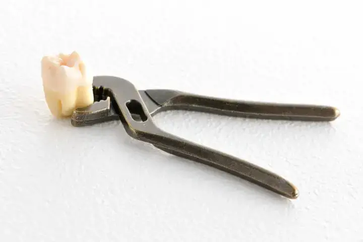 インビザライン矯正のアタッチメント5種類