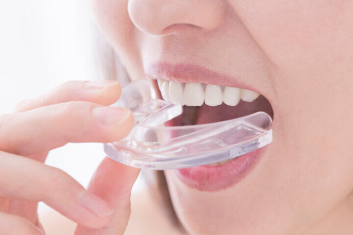 インビザラインで出っ歯は治せるのか？