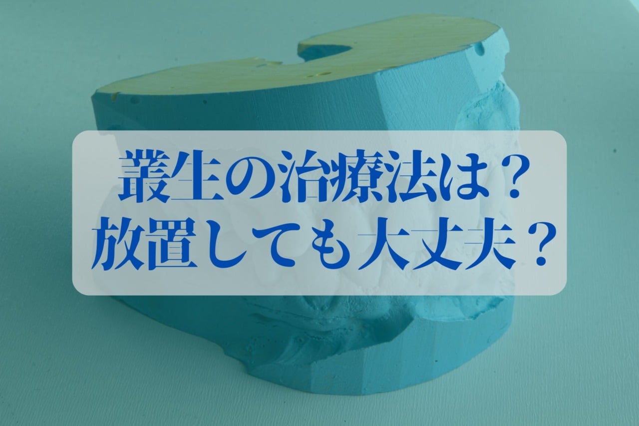 叢生の症状、原因、矯正方法を徹底解説！リスク、治療費用・期間は？