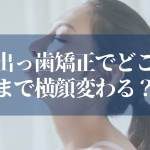 出っ歯矯正で横顔変わる？効果を永続的に守る方法完全解説！