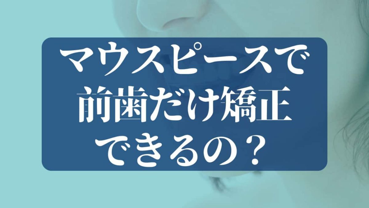 前歯だけのマウスピース矯正ができる人は？セルフチェック方法・値段・期間を専門医が解説|芦屋M&S歯科・矯正クリニック