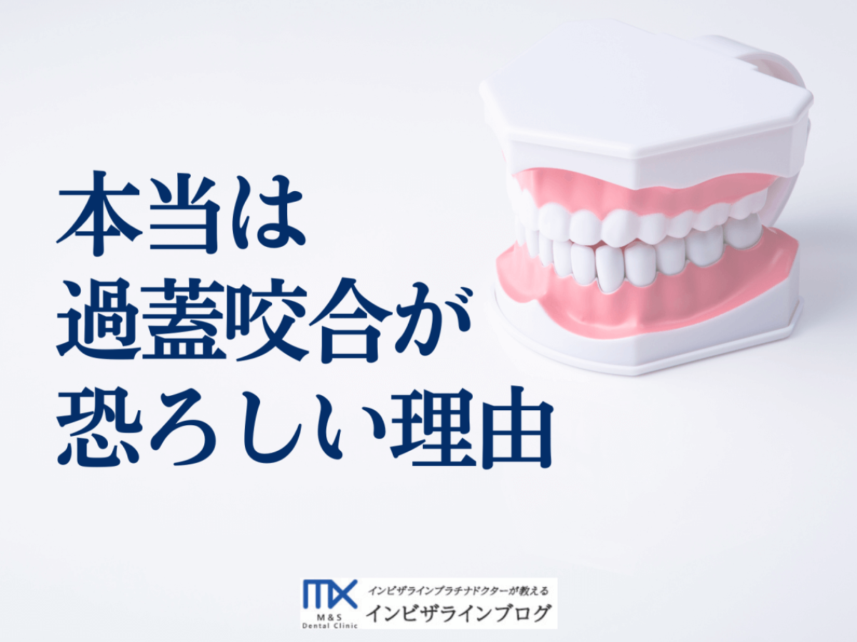 過蓋咬合とは？原因・放置リスク・矯正治療での改善方法徹底解説