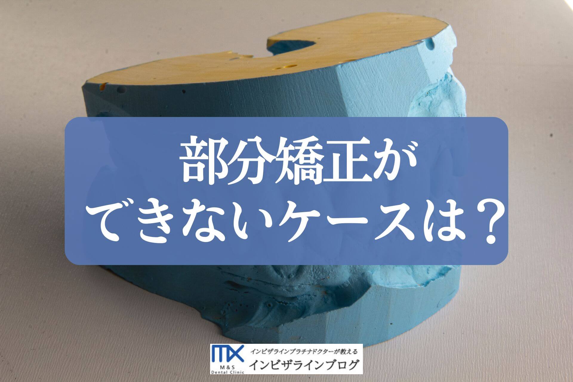 部分矯正ができない例とできる例の境は？判断基準・対処法を歯科医が解説