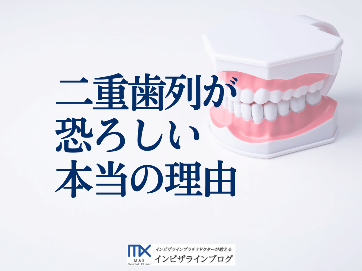 二重歯列とは？矯正費用・放置リスク・保険適用条件まで徹底解説|芦屋
