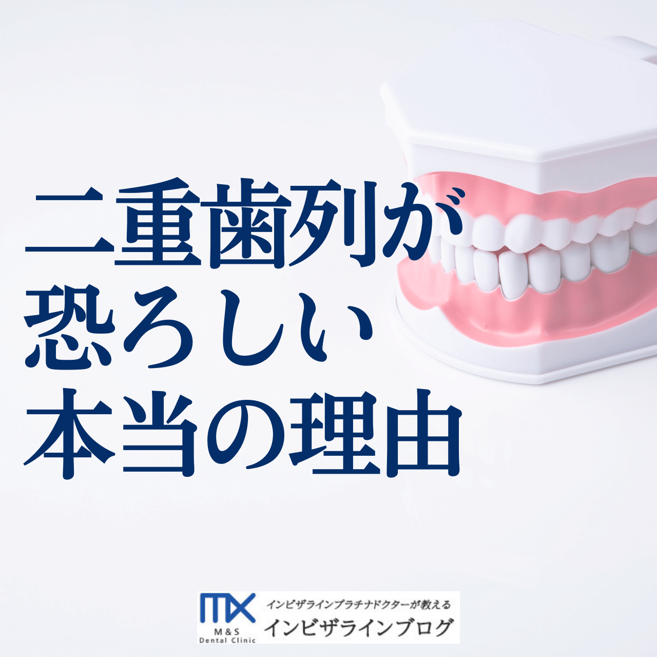 二重歯列とは？矯正費用・放置リスク・保険適用条件まで徹底解説|芦屋