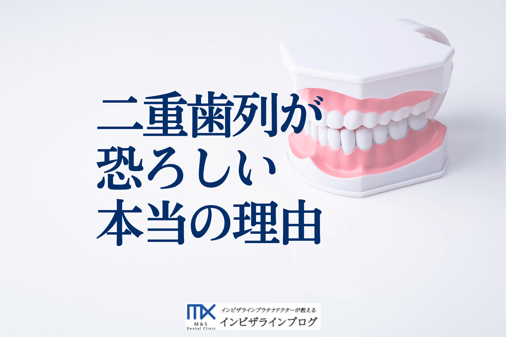 二重歯列とは？矯正費用・放置リスク・保険適用条件まで徹底解説