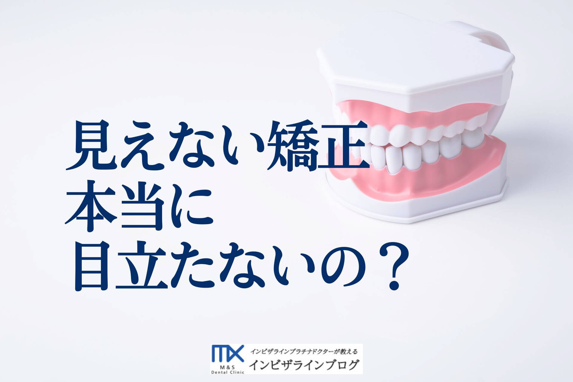 見えない・目立たない矯正の種類と価格の比較！治療期間や効果も徹底解説