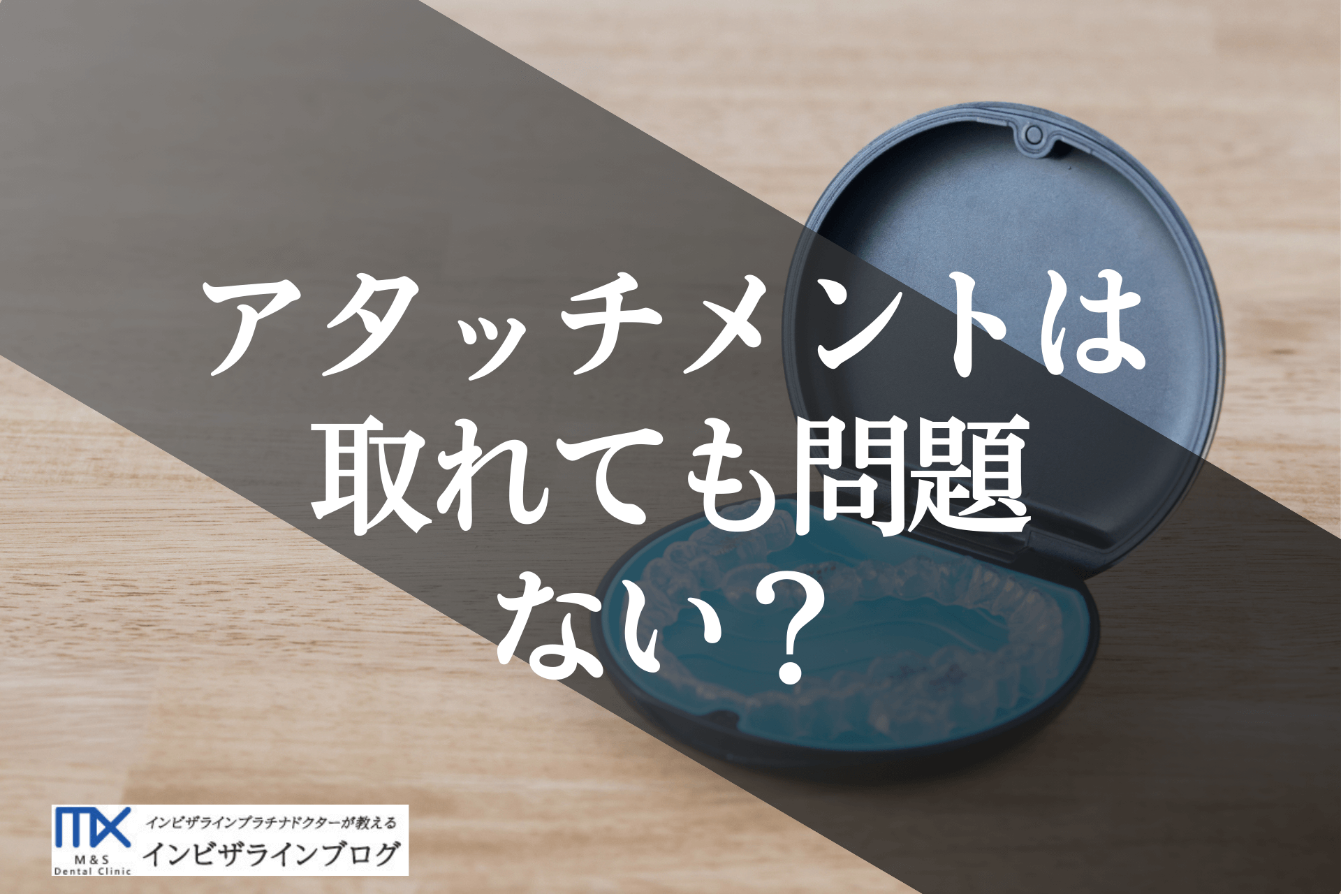 インビザラインのアタッチメントがすぐ取れる？原因と対処法、費用まで専門医が徹底解説