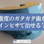 インビザラインで叢生（ガタガタ歯）はどこまで治せる？重度も改善できるか歯科医が解説！