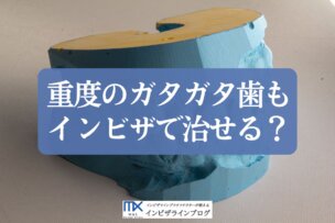 インビザラインで叢生（ガタガタ歯）はどこまで治せる？重度も改善できるか歯科医が解説！