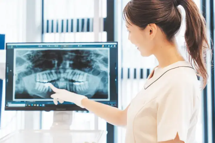 インビザラインは本当に虫歯になりにくい?