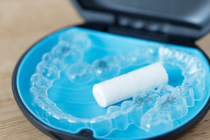 インビザラインで口内炎ができる３大原因とは？