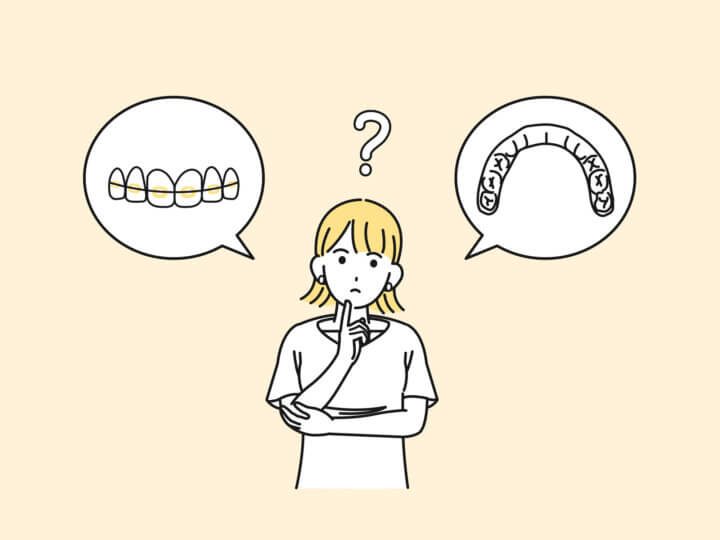 ワイヤー矯正とインビザライン、開咬ならどっちが安心？