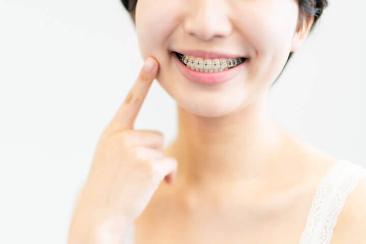 インビザラインだけでは改善が難しいガミースマイルは?