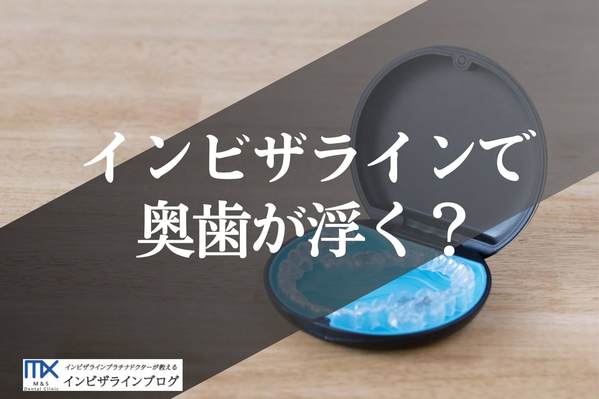 インビザラインで奥歯がパカパカ浮く原因は？許容範囲の見分け方を歯科医師が解説！