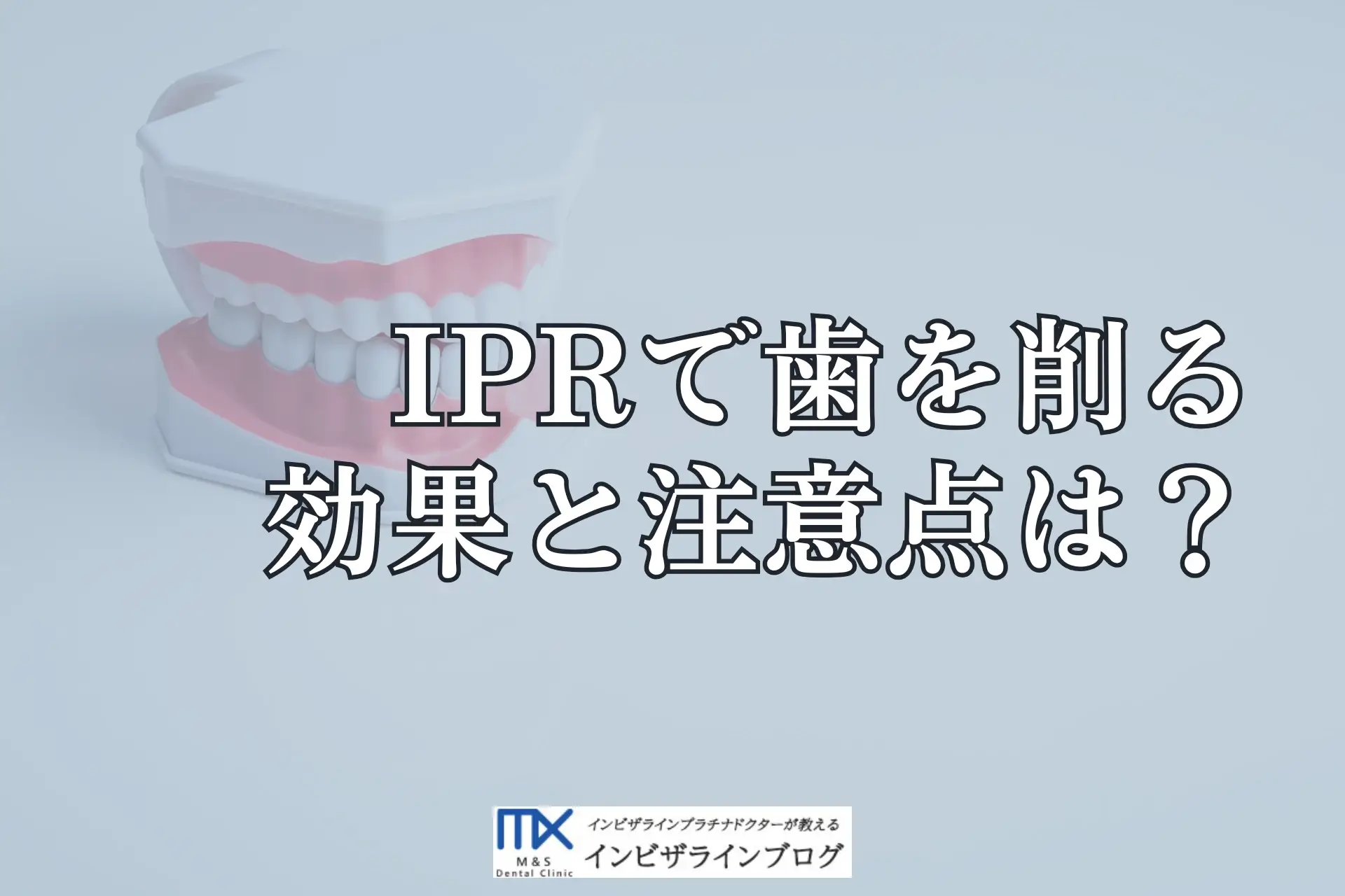 インビザラインのIPR（歯間削合）とは何か、削る量・安全性・必要なケースを歯科医が解説