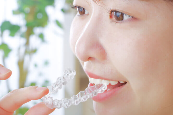 インビザラインで奥歯だけがパカパカ浮きやすい原因は？