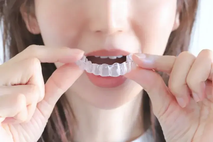 インビザラインで前歯のみを部分矯正する費用はいくら？