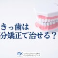すきっ歯は前歯だけの矯正で治せる？判断基準・費用相場・後戻り防止まで解説