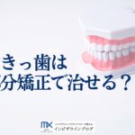 すきっ歯は前歯だけの矯正で治せる？判断基準・費用相場・後戻り防止まで解説