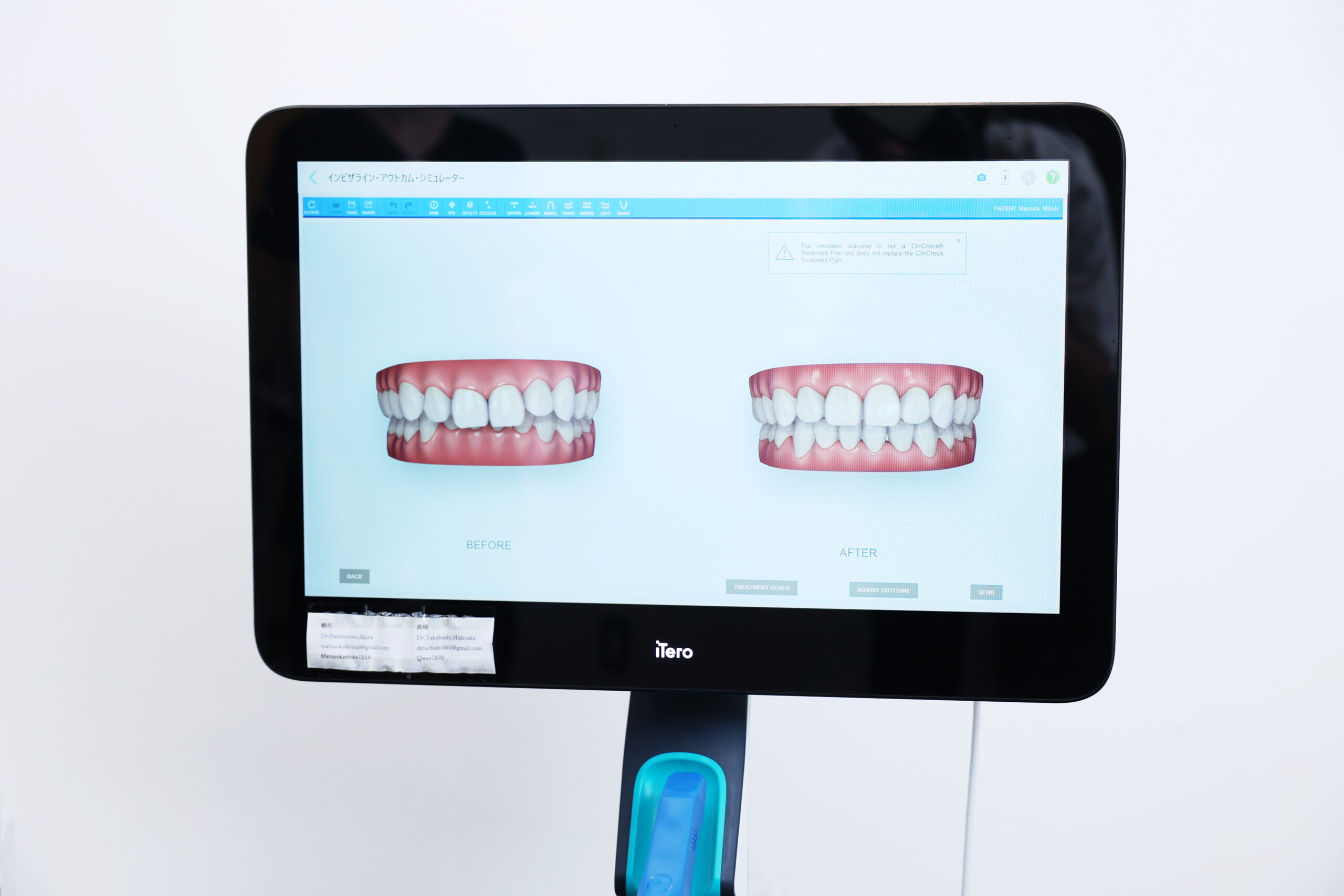 的確な診断のための設備